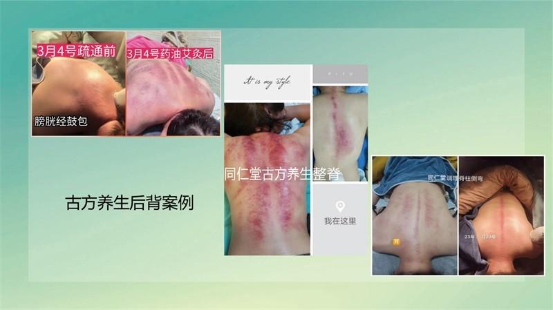 中医古方减肥_美容美发中医古方_秀域古方减肥遭曝光 腾讯