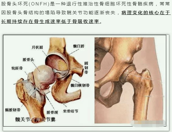 中医治疗焦虑症方子_中医中要方子股骨头_中医治疗脸部皮肤过敏的方子