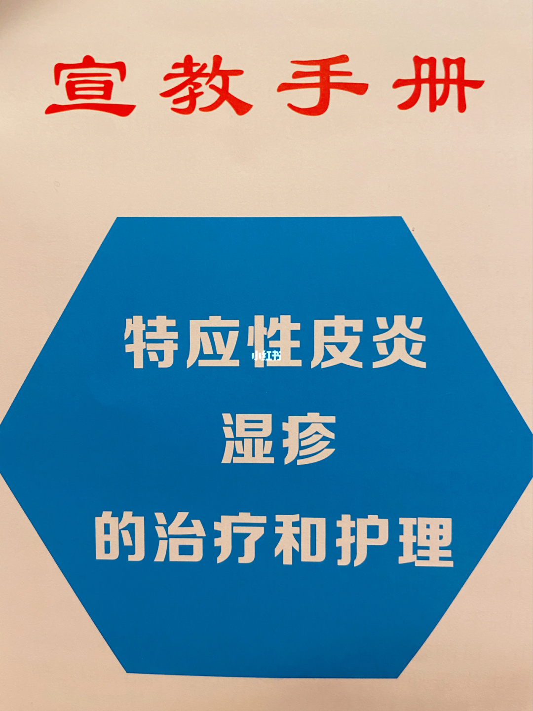 治疗手癣的偏方_中医治疗手癣_手癣中医治疗好吗