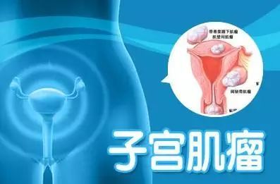 中医治疗多发子宫肌瘤_子宫多发肌瘤是什么意思_子宫多发肌瘤是什么