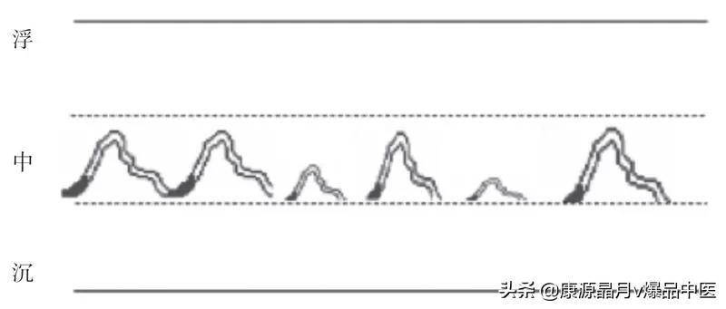 中医脉诀歌_脉道中医经络养生_中医脉学
